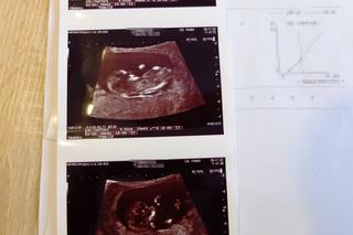 Mogli stracić dziecko przez błąd lekarki?