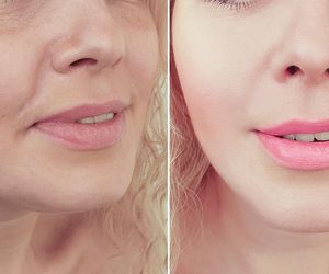 Kosmetyczne żelazko działa w każdym wieku. Wypróbuj!