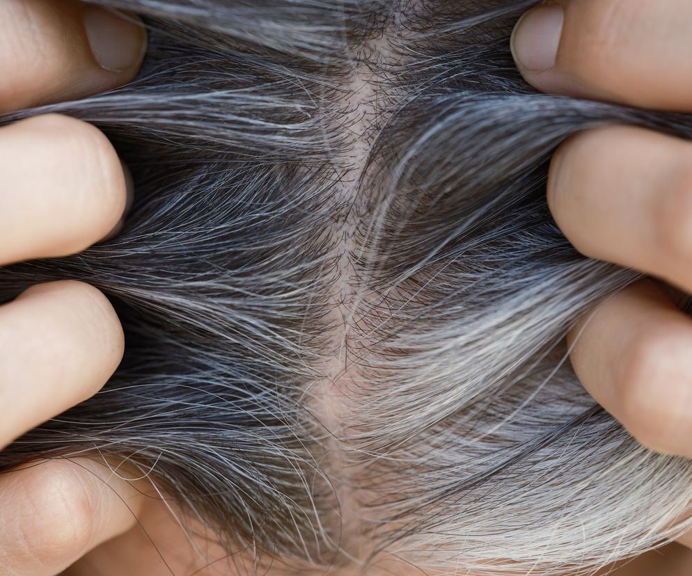 Dlaczego włosy siwieją? Winny może być niedobór tej witaminy