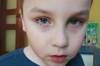 Oskar cierpi w ciszy. Każdy dzień to walka, by przeczekać ból. Mama nie ma już sił