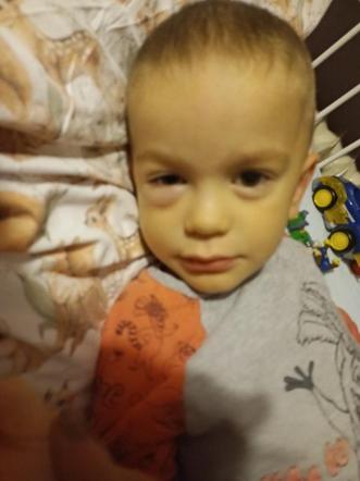 3-letni Wojtuś walczy z ETMR. Nadzieją jest zagraniczna terapia