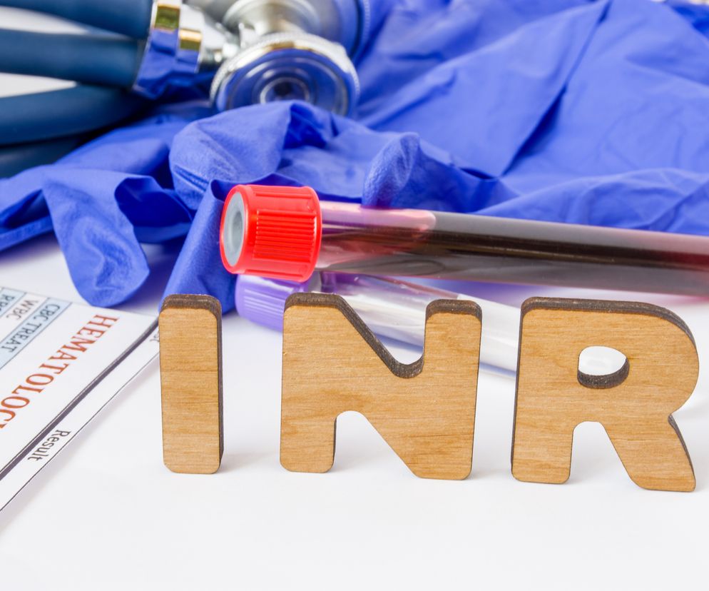 Badanie INR - wskazania, wyniki, normy