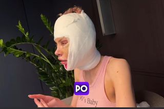 Julia Von Stein po operacji 