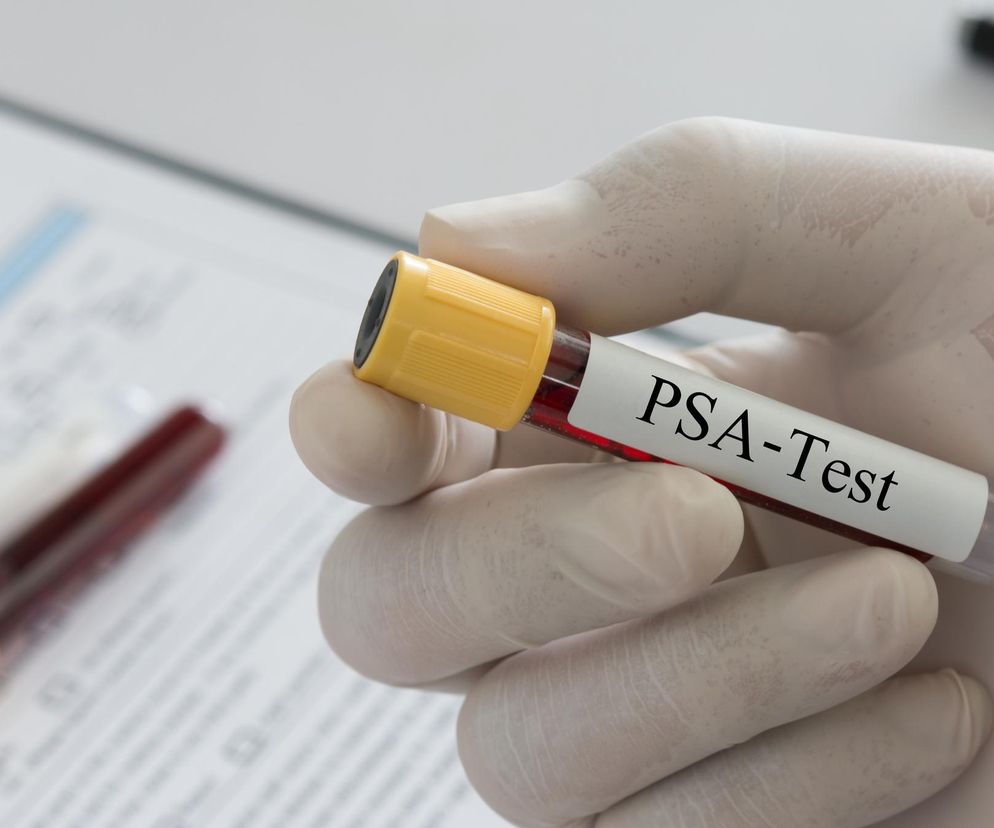 Raka prostaty może mieć co trzeci mężczyzna. Zachowaj czujność i zrób dwa proste badania