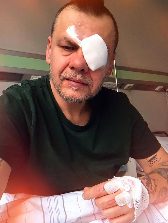 Artur Rawicz miał raka. Prawie stracił oko