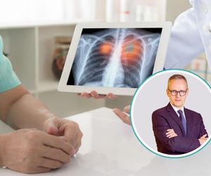 Pacjenci z rakiem płuca tracą bezcenne miesiące na diagnostykę. Ekspert wskazuje, co może wydłużyć życie tysięcy pacjentów 