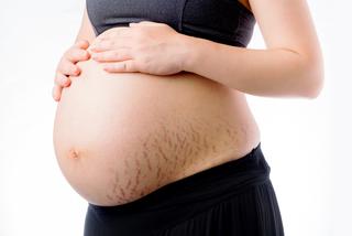 Rozstępy w zaawansowanej ciąży
