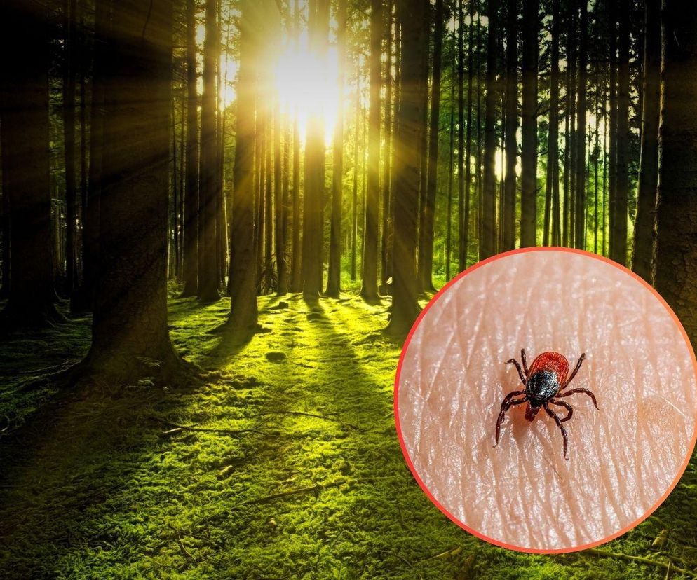 Rośnie liczba zakażeń boreliozą na Śląsku