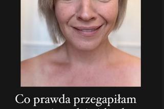 Szelągowska pokazała zmarszczki nie zgadniesz do czego je porównała.