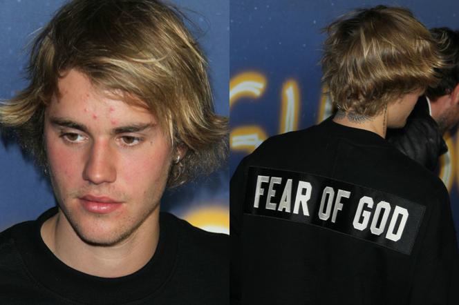 Justin Bieber i jego pryszcze na premierze Midnight Sun. Kłopoty z cerą? [GALERIA]