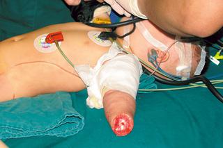 Babcia obcięła wnuczce rączki!