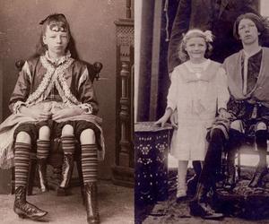 Miała cztery nogi. Była cyrkową atrakcją, mimo to urodziła pięcioro dzieci 