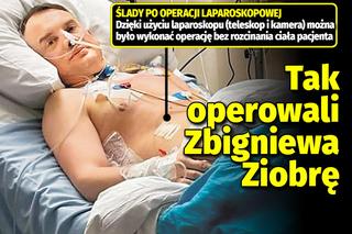 Tak operowali Zbigniewa Ziobrę