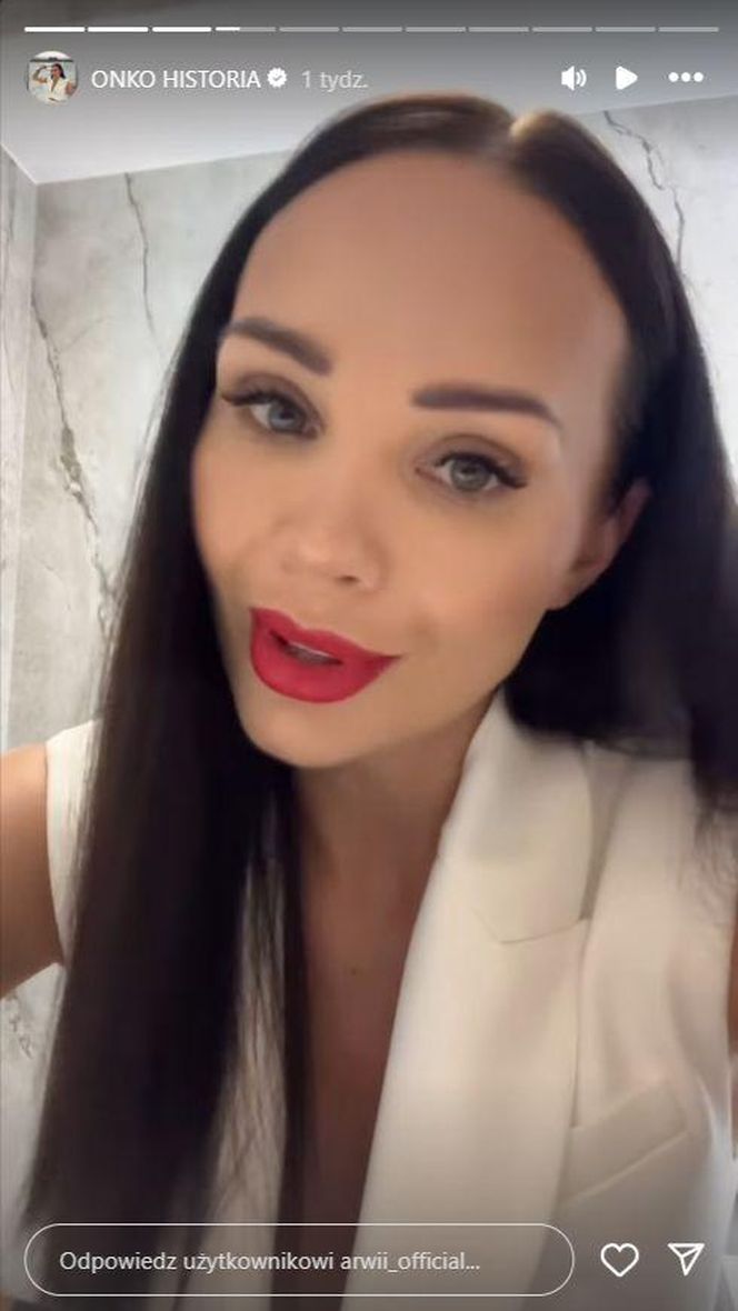 Arwena z "Farmy" przeszła mastektomię