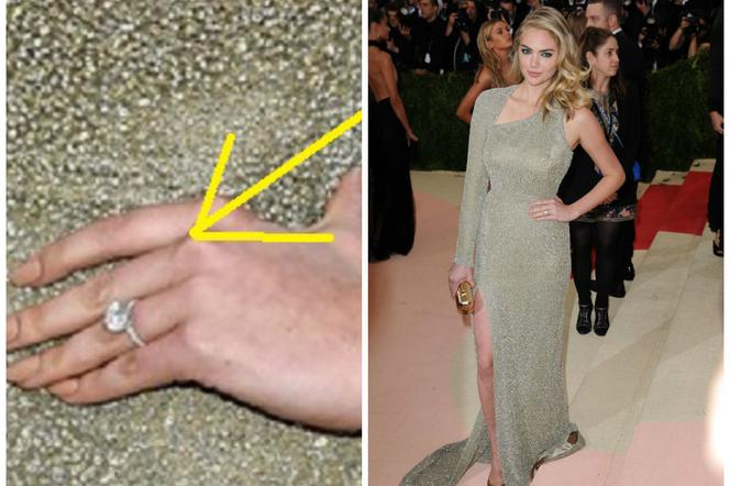 Met Gala 2016 Kate Upton