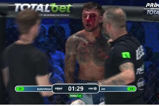 Zmasakrowana twarz gwiazdy PRIME MMA 9. To było bardzo brutalne! Walkę przerwał lekarz [ZDJĘCIE]