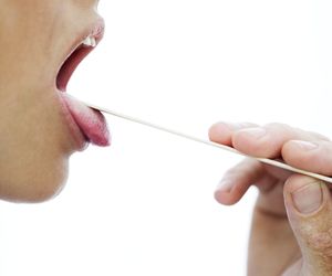 Leukoplakia włochata: przyczyny, objawy, leczenie