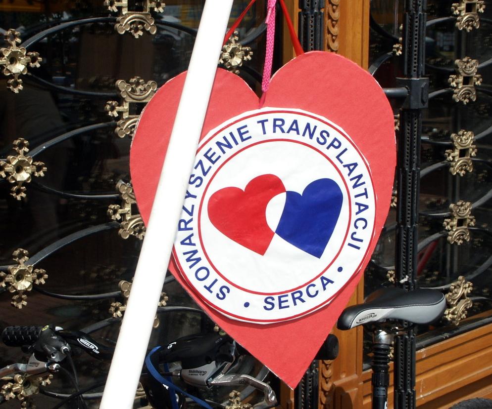 transplantacje, przeszczepy, przeszczepienia