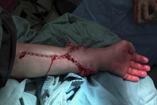 PIERWSZY TEGO TYPU PRZESZCZEP.