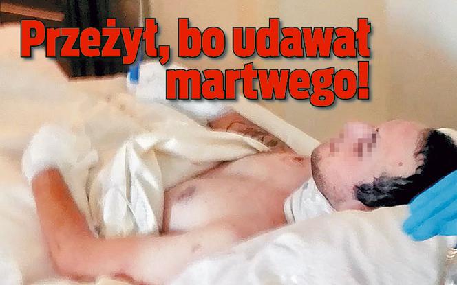 Przeżył bo udawał martwego