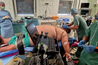 Rekordowa operacja w Kielcach. Chirurdzy zoperowali pacjenta ważącego 230 kg