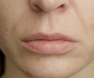 Dwa nietypowe objawy raka tarczycy. Jeden zauważysz na twarzy