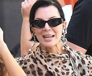 Kupiła sobie nową twarz za 360 tysięcy złotych! Nie poznasz tej gwiazdy