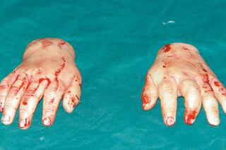 Babcia obcięła wnuczce rączki!