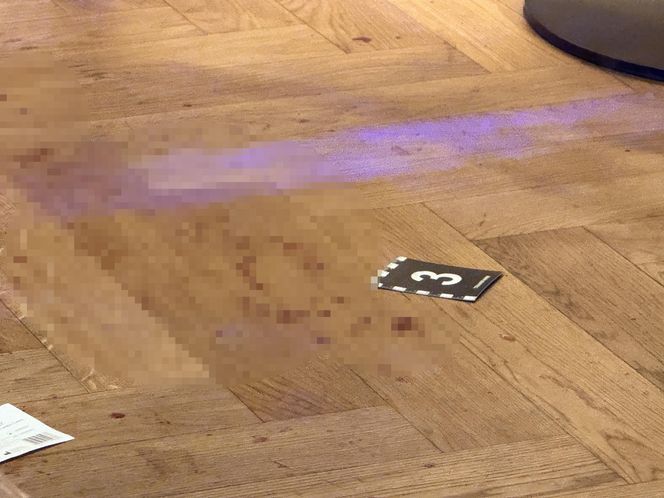 Atak nożownika w hotelu