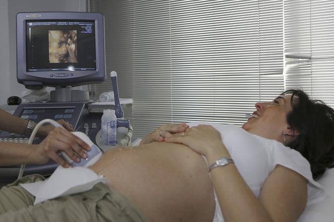 Kobiety w ciąży będą mogły w niedzielę wykonać bezpłatne USG 4D. Czekają tez pokazy dla młodych mam i konkursy