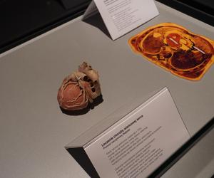 Wystawa z ludzkiego ciała. Body Worlds powróciła do Gdańska po 5 latach 