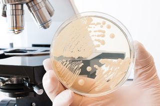 Kryptokokoza (drożdżyca europejska, toruloza): objawy i leczenie