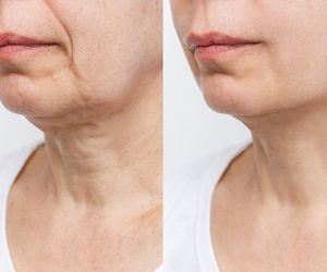 Koniec z indyczą szyją. Tym prostym sposobem pokonasz ten problem