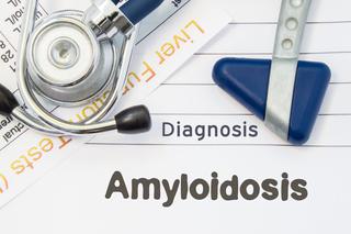 Amyloidoza (skrobiawica): przyczyny, objawy, leczenie