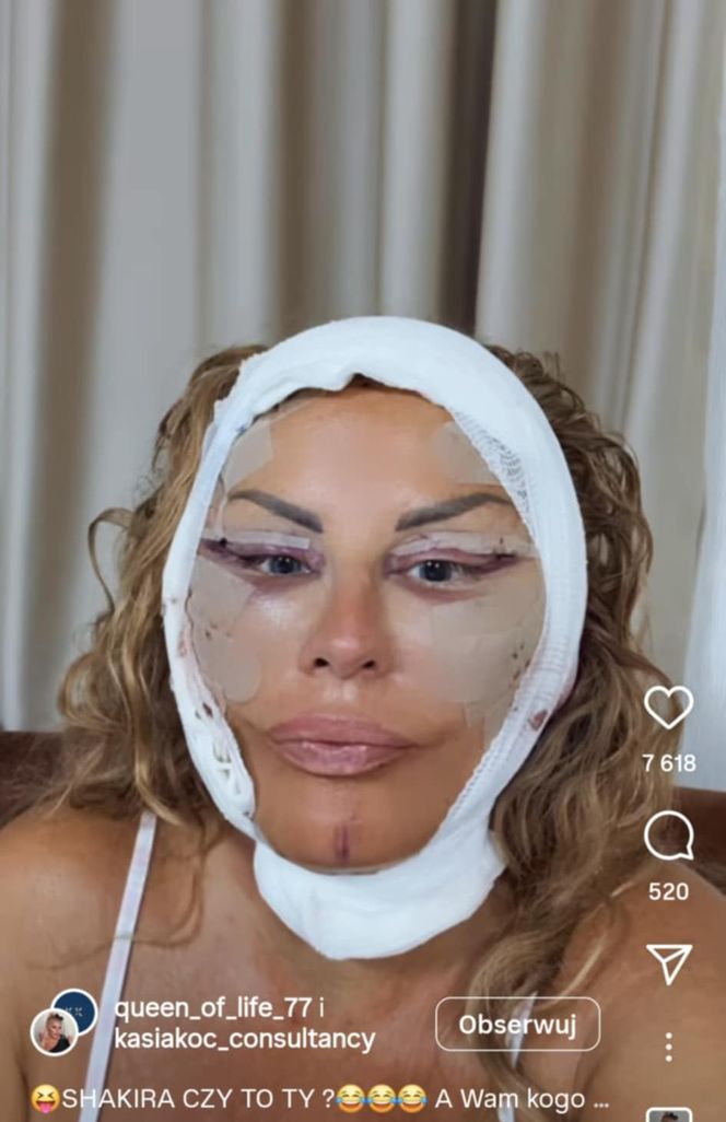 Dagmara Kaźmierska miała operację plastyczną