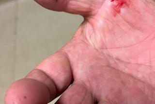 Były szef ZKP pogryziony przez trzy psy