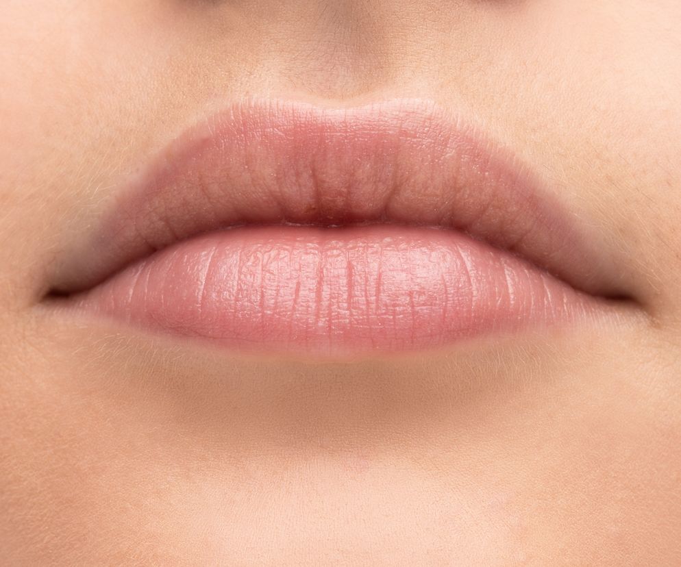 Plamki Fordyce'a: żółte lub czerwone plamki i grudki