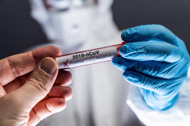 Szef WHO: pandemia COVID-19 jeszcze długo się nie skończy! Wirus szybko się  rozprzestrzenia - ESKA.pl