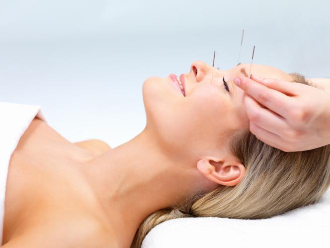 Akupunktura odmładza. Sprawdź zalety akupunktury kosmetycznej