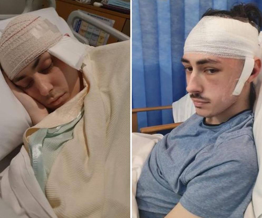 Miał guza mózgu wielkości grejpfruta. 23-latek od ponad roku walczy ze złośliwym nowotworem