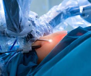 Szpital Rydygiera zaczyna operować przy pomocy robota da Vinci 
