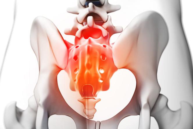 Ból kości ogonowej – przyczyny. Co powoduje ból kości ogonowej?