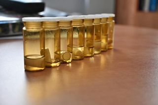 Takie przedmioty lekarze znajdują w płucach pacjentów