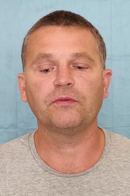 Wydrukowali mu nowe kości twarzy