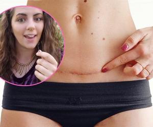 Ma za sobą osiem cesarskich cięć. Niewiarygodne, ile ma lat