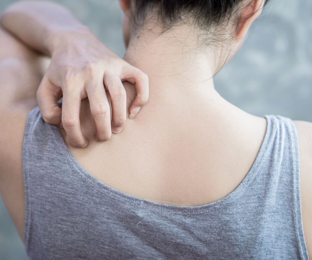 Kobieta drapie się po karku
