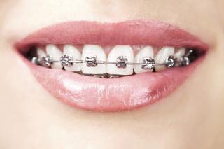 Kiedy potrzebny ortodonta?
