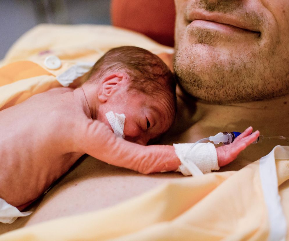 Powikłania wcześniactwa i choroby wcześniaków. Czym jest syndrom wcześniaka?