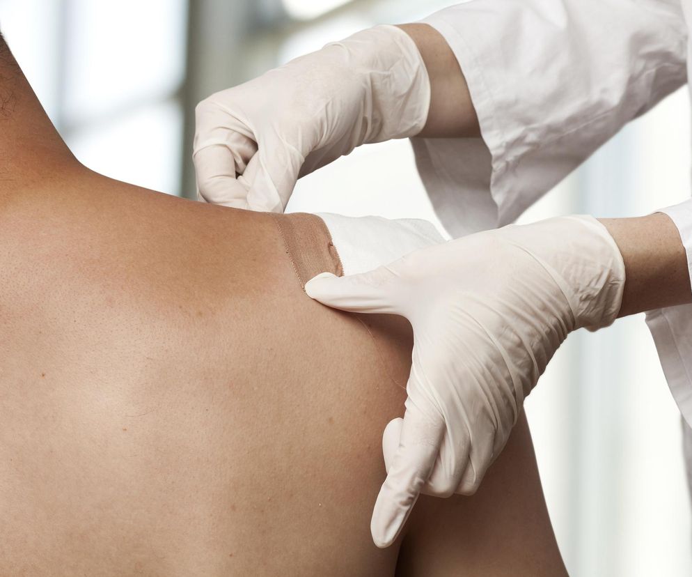 Jak zmienić opatrunek? Instrukcja krok po kroku