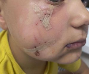 Pogryziony Franek potrzebuje pomocy. Policja szuka właściciela psa. Do szpitala dotarła anonimowa wiadomość